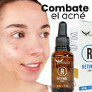 Retinol Afrodita