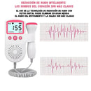 Realiza Tu Orden AQUÍ - FetalDoopler™ - Monitor Fetal Portátil